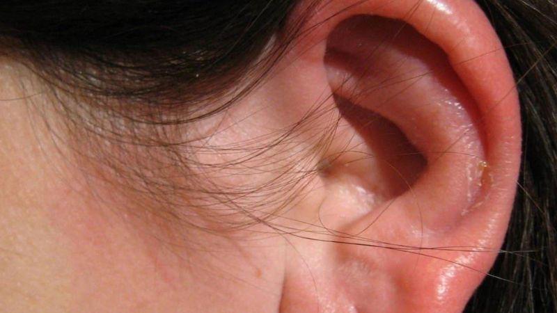 Những thực phẩm nào người bị viêm tai giữa nên kiêng và nên bổ sung để hỗ trợ sức khỏe hiệu quả?