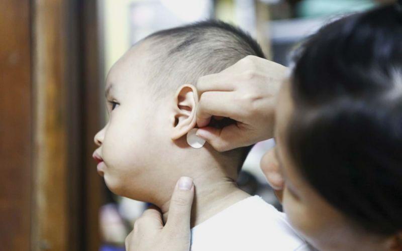 Miếng dán chống say tàu xe là một phương pháp hiệu quả giúp giảm các triệu chứng say xe. Vậy sản phẩm này là gì và cần lưu ý gì khi sử dụng?