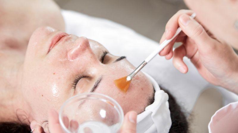 Mẹ bầu có thể thực hiện peel da không? Những lưu ý khi bà bầu quyết định peel da