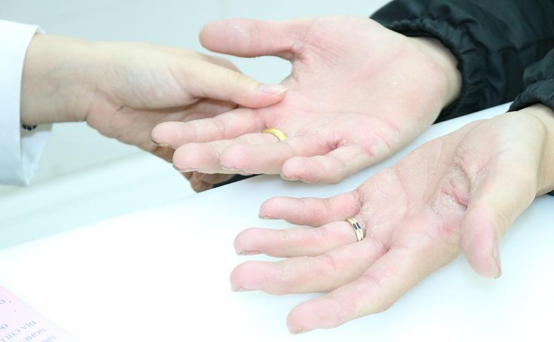 Kem dưỡng ẩm Vaseline cho da tay và móng tay có thực sự mang lại hiệu quả hay không?