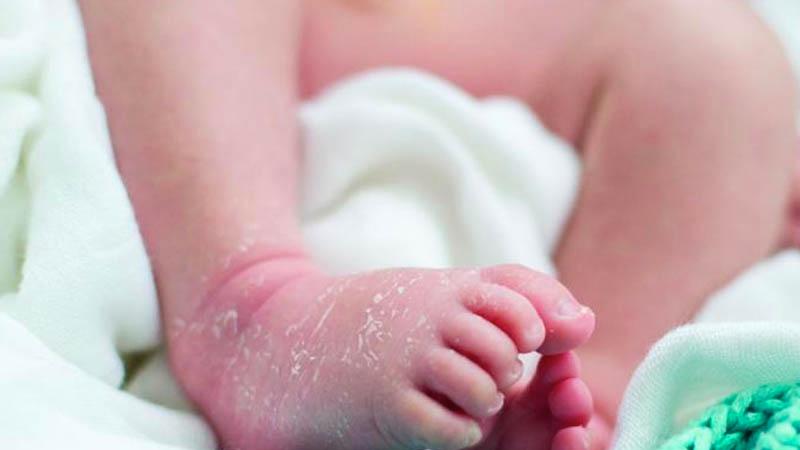 Vì sao trẻ em lại gặp phải tình trạng da tay chân bị bong tróc? Đây là một vấn đề khiến nhiều bậc phụ huynh cảm thấy lo lắng và cần tìm hiểu rõ nguyên nhân để có hướng xử lý kịp thời.