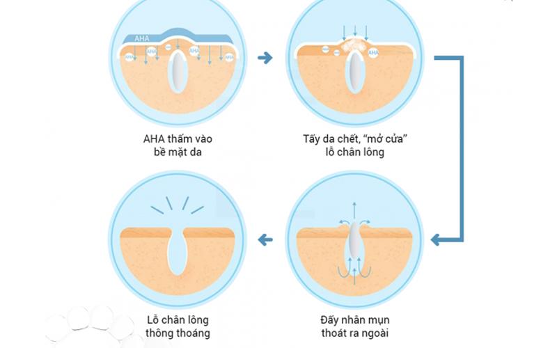 Khám phá phương pháp sử dụng AHA hiệu quả để đạt được làn da đẹp như ý