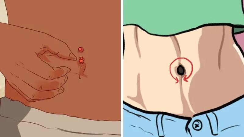 Rốn có mùi hôi, làm sao để khắc phục? Nguyên nhân và cách xử lý hiệu quả