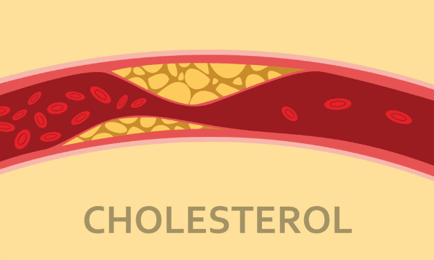 Cholesterol là một thành phần quan trọng trong cơ thể, có mặt ở mọi tế bào và đóng vai trò thiết yếu đối với sức khỏe con người. Bạn đã hiểu rõ về Cholesterol và các loại của nó, cũng như tầm quan trọng của chúng đối với cơ thể? Cùng khám phá trong bài viết này.