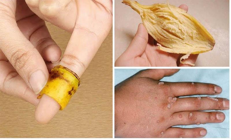 Khám phá 5 bí quyết làm đẹp tuyệt vời từ vỏ chuối mà ít ai biết đến