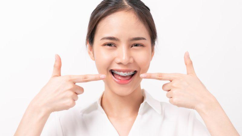 Liệu ở độ tuổi 30, niềng răng có còn phù hợp không? Cùng khám phá xem độ tuổi nào thực sự là lý tưởng để thực hiện niềng răng.