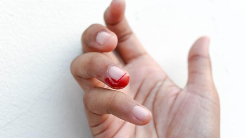 Liệu việc cắt móng tay quá sát có thực sự gây hại cho tim mạch?