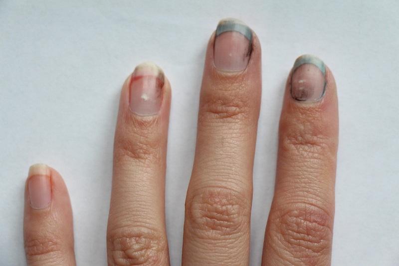 Mẹo làm sạch mủ rau muống bám trên tay nhanh chóng