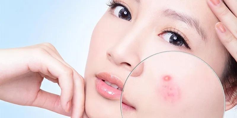 Vì sao sữa chua là 'thần dược' cho làn da?