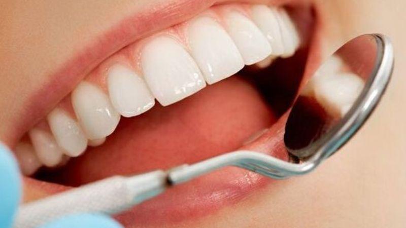 Liệu bọc răng sứ Mỹ có phải là sự lựa chọn tối ưu cho nụ cười của bạn? Hãy cùng tìm hiểu các loại răng sứ Mỹ phổ biến và đánh giá chất lượng của chúng.