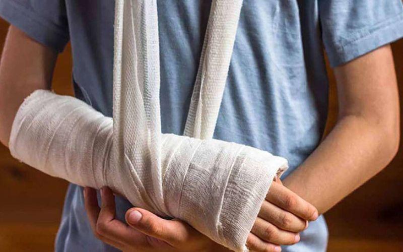 Bó bột là phương pháp giúp cố định xương sau chấn thương, đảm bảo xương không bị di chuyển và hỗ trợ quá trình lành lại. Vậy, khi nào thì cần thực hiện bó bột?