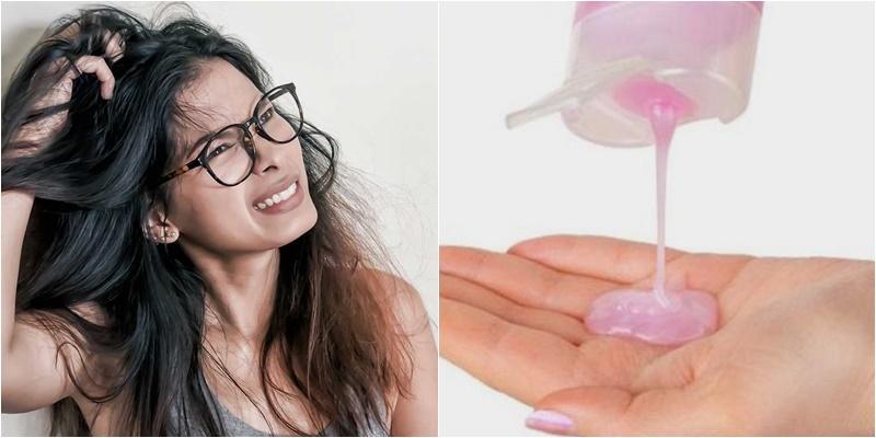 Những bí quyết giảm ngứa da đầu không thể bỏ qua