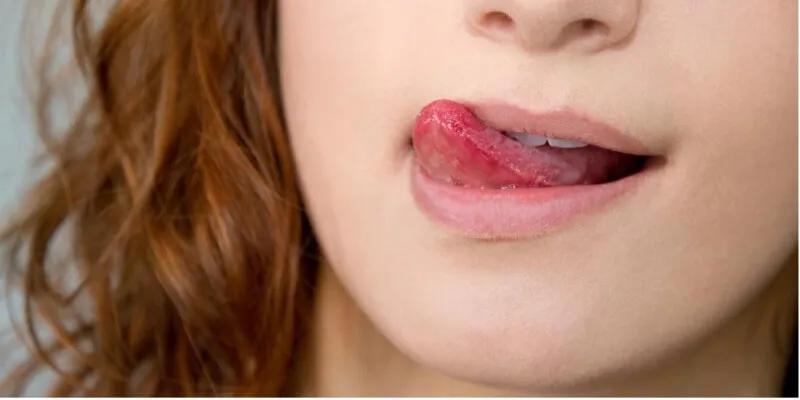 "Kẻ thủ ác" khiến đôi môi khô ráp, nứt nẻ quanh năm mà bạn chưa hề nhận ra
