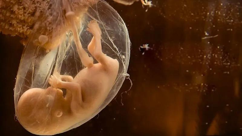 Liệu nước ối đục có gây nguy hiểm cho mẹ và bé không?
