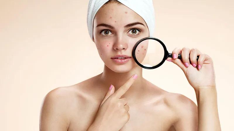 Oxy già – một sản phẩm quen thuộc trong mỗi gia đình, không chỉ giúp làm sạch vết thương mà còn có vô vàn công dụng hữu ích khác. Khám phá ngay những lý do bạn cần phải sở hữu một chai oxy già trong nhà.
