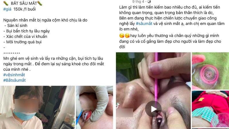 Dịch vụ bắt sâu mắt tại các spa đang khiến nhiều chị em tiền mất tật mang, tiềm ẩn nhiều rủi ro nguy hiểm cho đôi mắt.