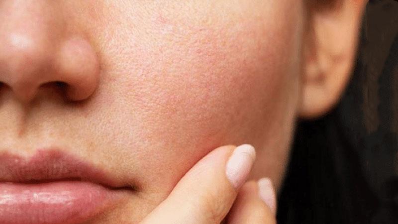 Danh sách các serum nổi bật được đánh giá cao, phù hợp cho từng loại da, giúp chăm sóc và nuôi dưỡng làn da hiệu quả.
