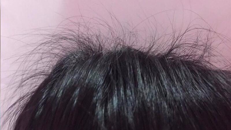 Làm sao để giải quyết tình trạng tóc con mọc lởm chởm?
