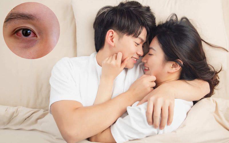 Khi mắc đau mắt đỏ, liệu có cần tránh quan hệ tình dục? Những điều cần lưu ý để bảo vệ sức khỏe.