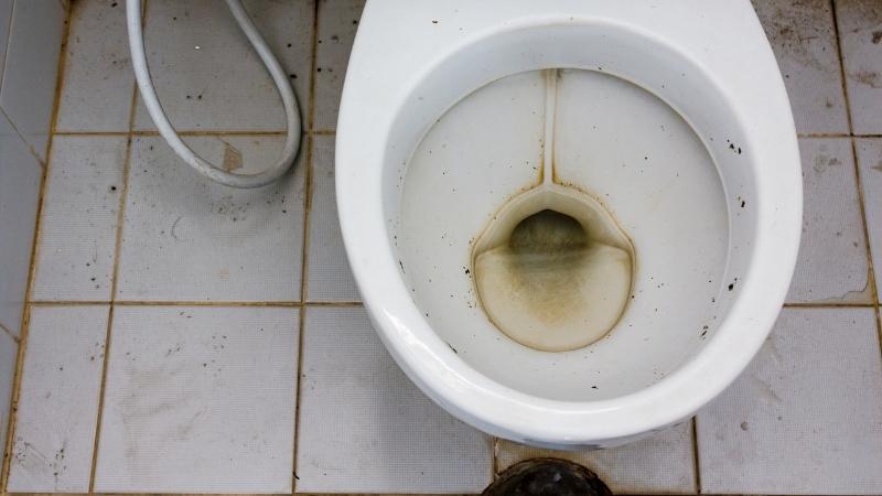 Khám phá 8 phương pháp giúp loại bỏ vết ố vàng lâu ngày, trả lại vẻ sáng bóng cho bồn cầu của bạn.