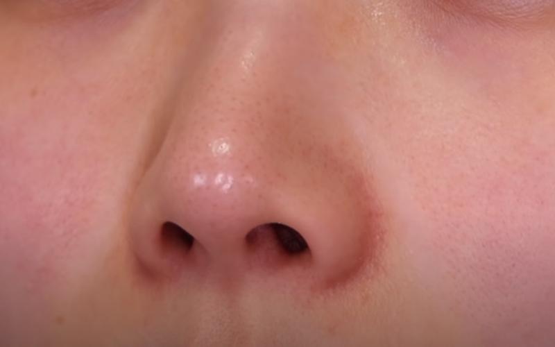 Beauty blogger Hàn chia sẻ phương pháp trị mụn đầu đen hiệu quả chỉ với Vaseline và dầu tẩy trang, giúp làn da bạn trở nên mịn màng và sáng khỏe.