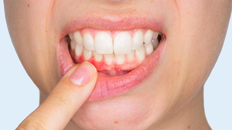 Vì sao một số người lại cảm thấy vị chua sau khi thưởng thức đồ ngọt?
