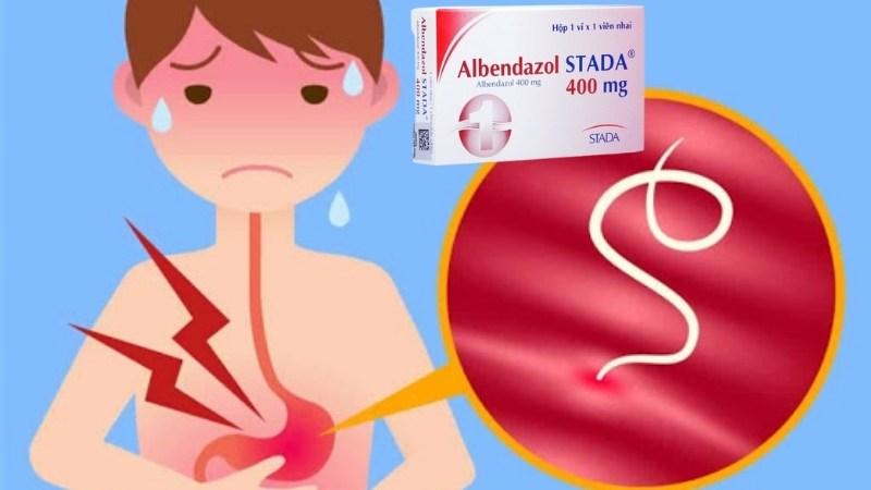 Albendazol – Công dụng, cách sử dụng và những lưu ý khi dùng thuốc tẩy giun