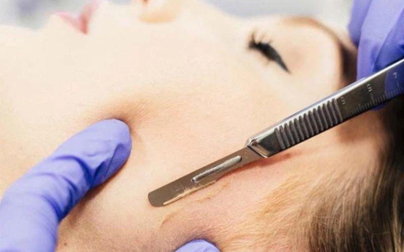 Cạo lông mặt khi cắt tóc: Thói quen này có thực sự tốt cho da?