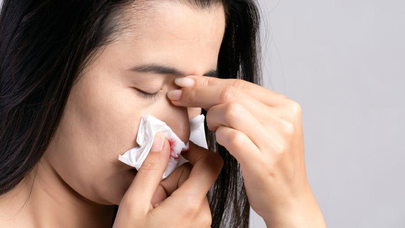 Làm gì khi bị chảy máu mũi? Cách xử trí đúng và kịp thời.