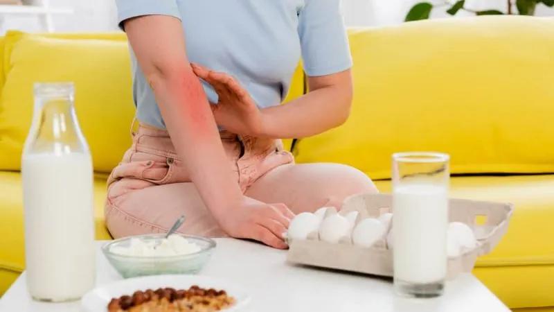 Dị ứng trứng: Nguyên nhân, triệu chứng và cách phòng ngừa hiệu quả
