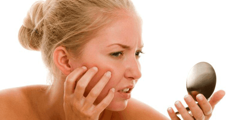 3 mẹo trị lang ben tại nhà bằng nguyên liệu tự nhiên, không cần thuốc