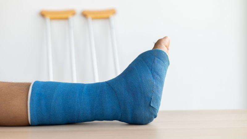 Hướng dẫn sơ cứu gãy xương đúng cách và nhanh chóng khi gặp tai nạn, giúp giảm thiểu nguy cơ biến chứng.