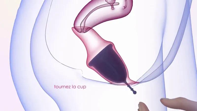 Cốc nguyệt san là gì? Liệu nó có thể thay thế băng vệ sinh trong kỳ kinh nguyệt không?