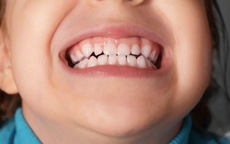 Vì sao trẻ em lại nghiến răng trong giấc ngủ? Liệu điều này có liên quan đến sự thiếu hụt chất dinh dưỡng nào không?