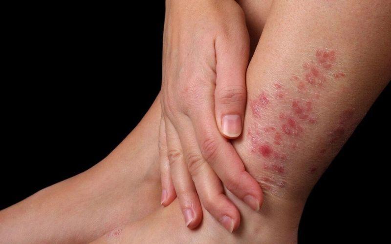 Chỉ cần một tuần ngâm chân với ngải cứu, bạn sẽ cảm nhận được những lợi ích tuyệt vời cho sức khỏe.