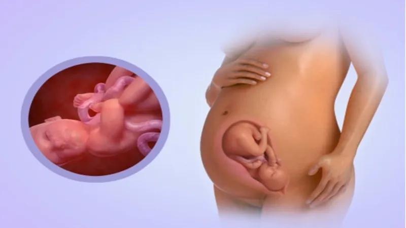 Chân của trẻ sơ sinh bị cong: Nguyên nhân và cách phòng tránh hiệu quả