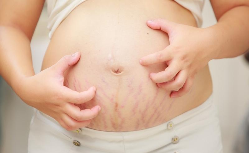 18 công dụng làm đẹp tuyệt vời từ vitamin E bạn không thể bỏ lỡ