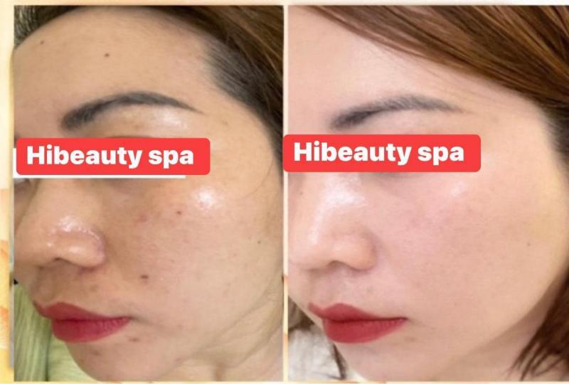 Top 4 spa chăm sóc da uy tín và chất lượng tại quận 9, TP.HCM