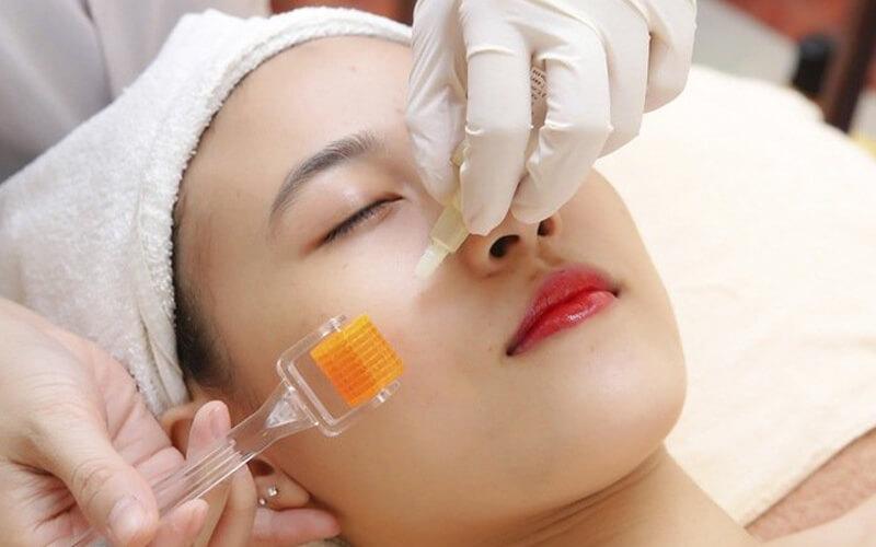 Khám phá về lăn kim tế bào gốc và những ưu điểm, nhược điểm của phương pháp này