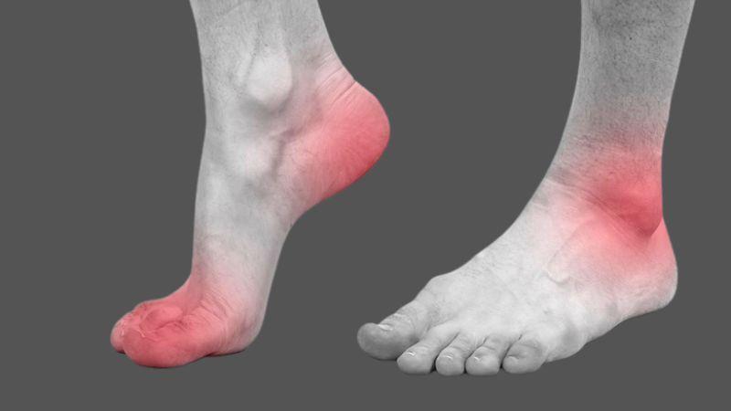 Hướng dẫn phục hồi nhanh chóng khi bị trật mắt cá chân ngay tại nhà