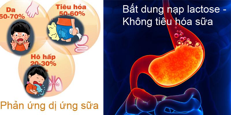 Hướng dẫn chọn bột ăn dặm cho trẻ bị dị ứng sữa bò