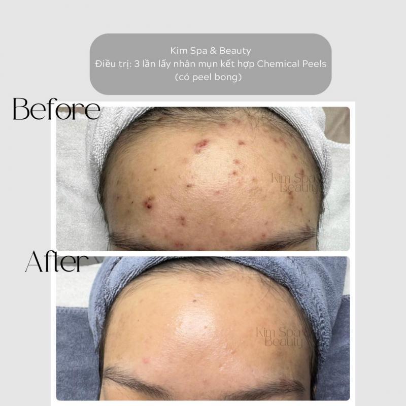 Top 7 Spa làm đẹp hàng đầu tại quận 4, TP. HCM