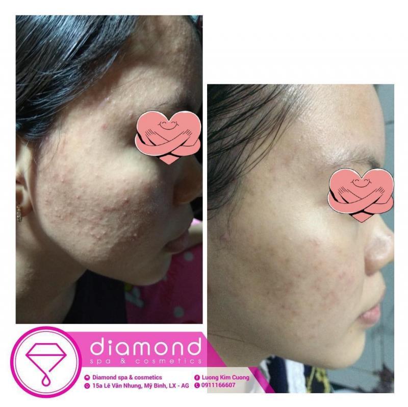 Top 11 Spa làm đẹp được yêu thích nhất tại TP. Long Xuyên, An Giang