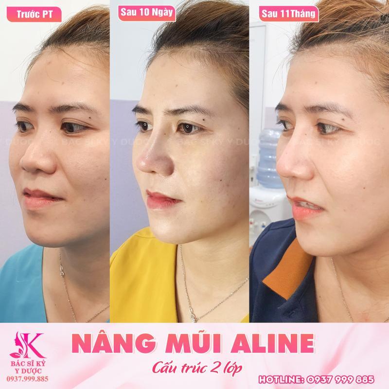 Top 7 địa chỉ nâng mũi uy tín và an toàn tại tỉnh Khánh Hòa