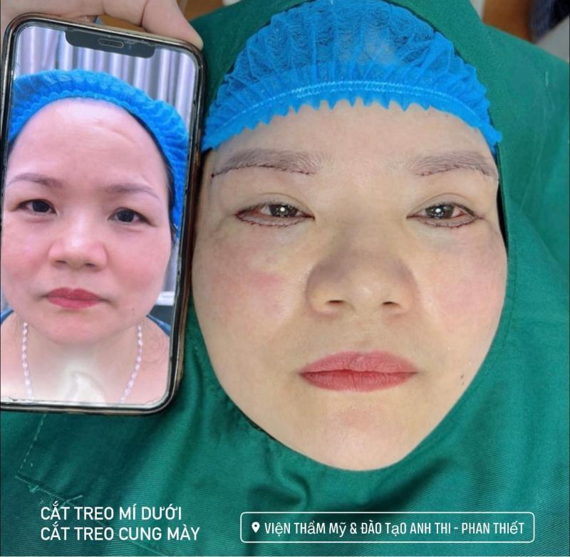 Khám phá top 4 địa chỉ nâng cung chân mày uy tín và đẹp nhất tại Bình Thuận