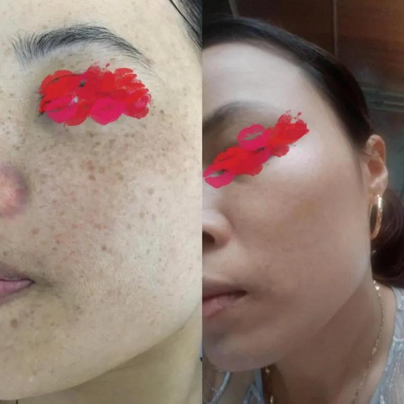 8 Phòng Khám Da Liễu Uy Tín Nhất Tại Tỉnh Thanh Hóa