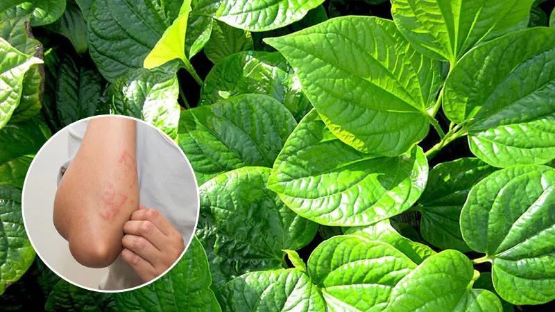Phương pháp chữa viêm da cơ địa bằng lá trầu không: Hiệu quả bất ngờ từ thiên nhiên