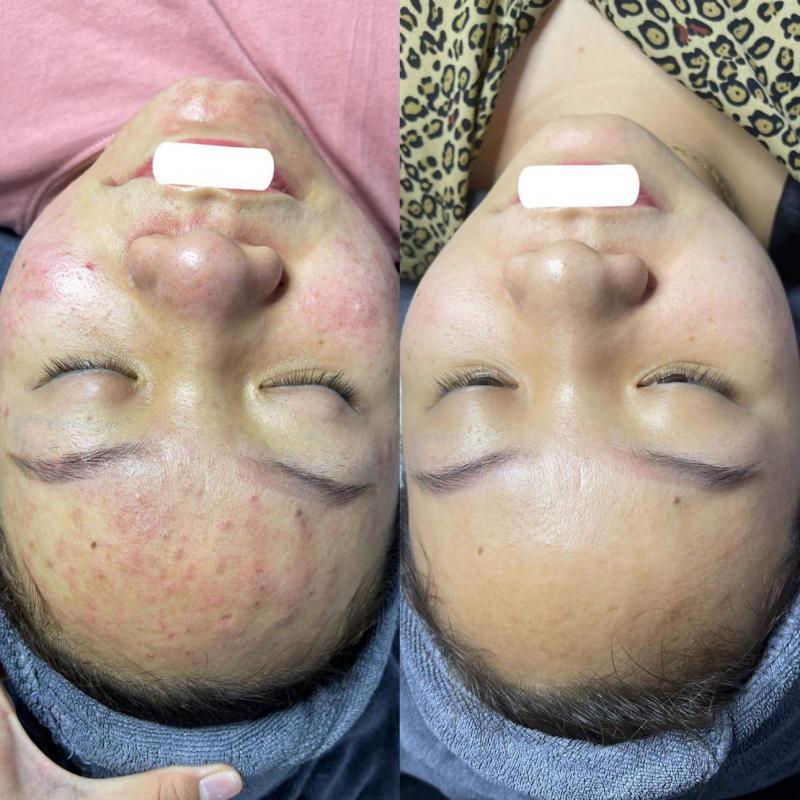 Khám phá 5 spa uy tín và chất lượng hàng đầu tại Lạng Sơn