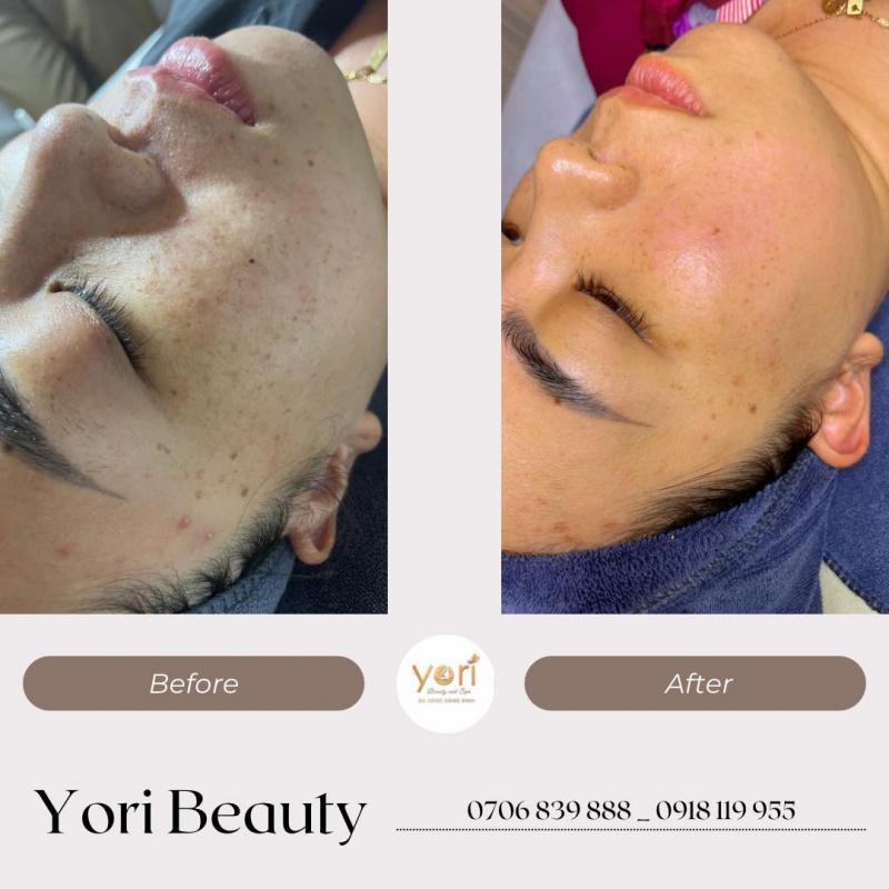 Top 6 Spa Chăm Sóc Da Chất Lượng Nhất Tại TP. Cần Thơ