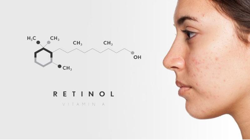 Khám phá cách dùng Retinol trị mụn và những lưu ý quan trọng